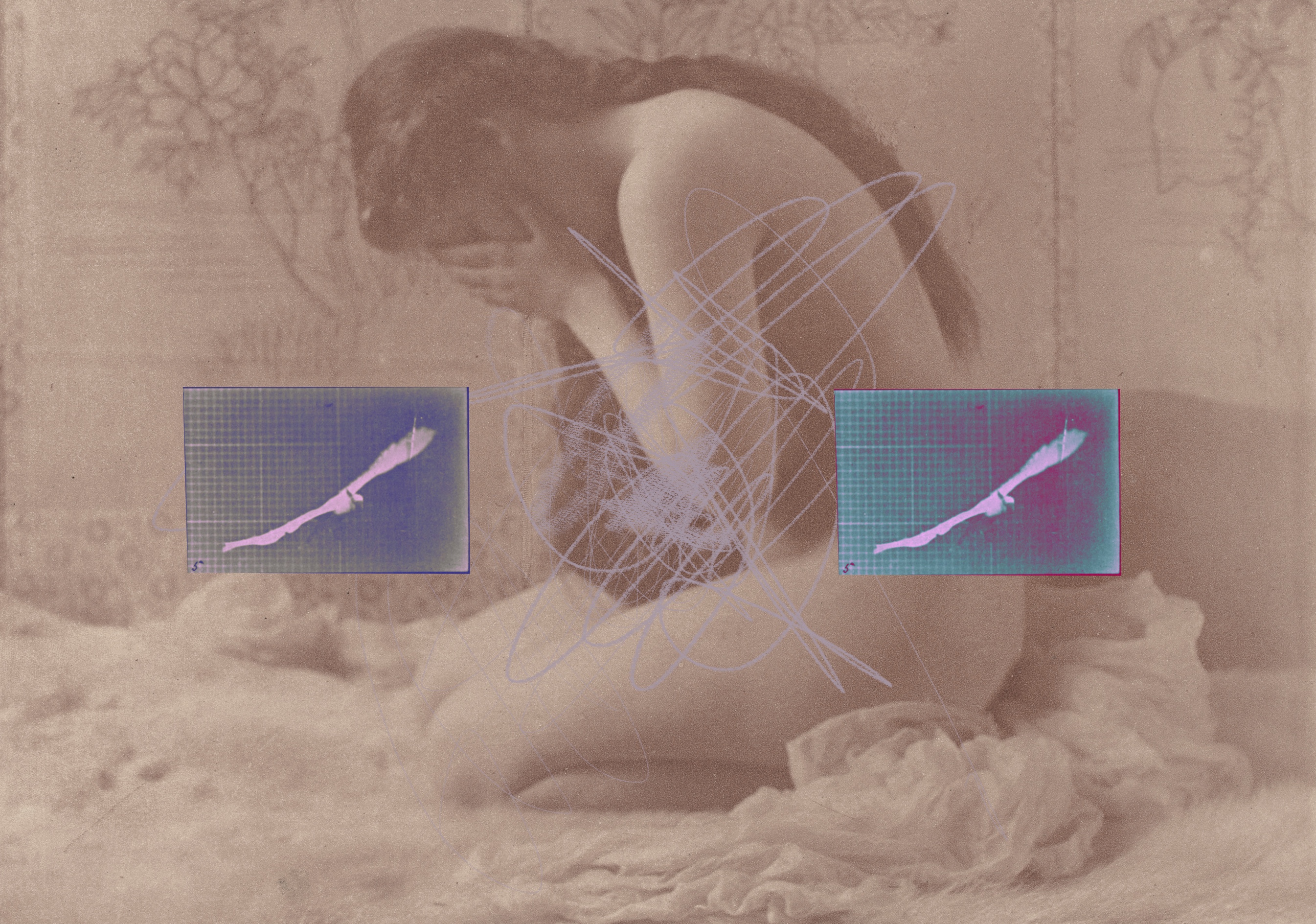 Melancholia